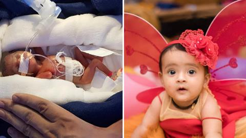 Προωράκι που γεννήθηκε 400 γραμμάρια σώθηκε από θαύμα και επέστρεψε σπίτι του υγιέστατο!